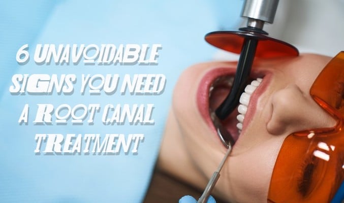 6 Unavoidable Signs You Need A Root Canal Treatment