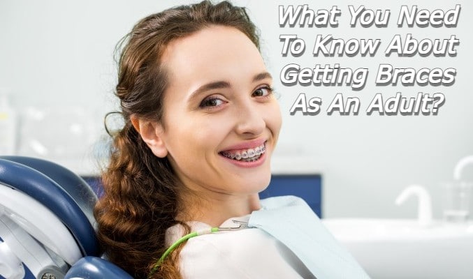 What You Need to Know About Getting Braces As An Adult?