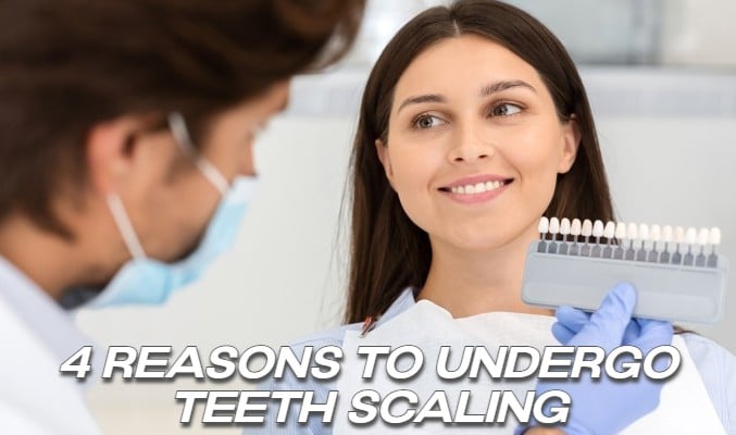 4 Reasons to Undergo Teeth Scaling
