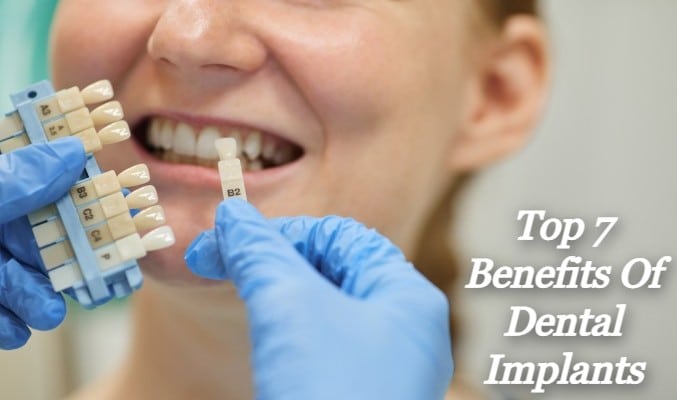Top 7 Benefits of Dental Implants