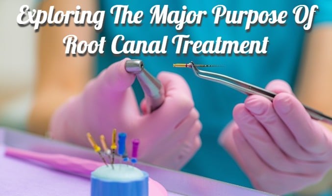 Exploring the Major Purpose of Root Canal Treatment